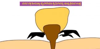 ಹಸುಗಳಲ್ಲಿ ಮಾರಕ ಉಣ್ಣೆ ರೋಗ; ಉದಾಸೀನ ಬೇಡ